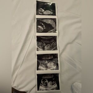 It’s a Girl 🎀 Baby Saad coming soon 6/23